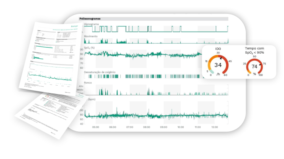 laudo do Exame do Sono Biologix®
